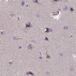 DUS2L Antibody in Immunohistochemistry (IHC)