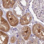 DUS2L Antibody in Immunohistochemistry (IHC)