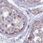 DUS2L Antibody in Immunohistochemistry (IHC)