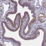 LGI4 Antibody in Immunohistochemistry (IHC)