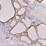 PRKCSH Antibody in Immunohistochemistry (IHC)