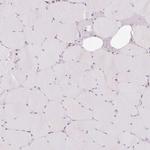 PRKCSH Antibody in Immunohistochemistry (IHC)