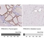 PRKCSH Antibody