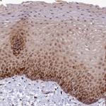 EARS2 Antibody in Immunohistochemistry (IHC)