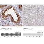 WDR62 Antibody