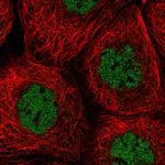 SNX20 Antibody in Immunocytochemistry (ICC/IF)