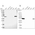 LPXN Antibody in Western Blot (WB)