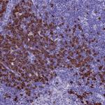 MZB1 Antibody in Immunohistochemistry (IHC)