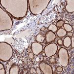 MRPS11 Antibody in Immunohistochemistry (IHC)