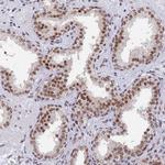 DPY30 Antibody in Immunohistochemistry (IHC)