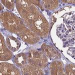 APOA1BP Antibody in Immunohistochemistry (IHC)