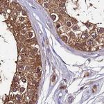 APOA1BP Antibody in Immunohistochemistry (IHC)