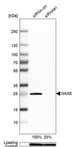 APOA1BP Antibody in Western Blot (WB)
