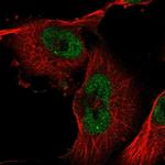 ZXDB Antibody in Immunocytochemistry (ICC/IF)