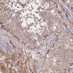 PTPMT1 Antibody in Immunohistochemistry (IHC)