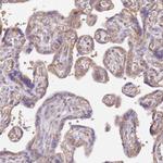 DOCK9 Antibody in Immunohistochemistry (IHC)