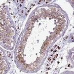 VPS36 Antibody in Immunohistochemistry (IHC)