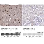 DBNDD2 Antibody in Immunohistochemistry (IHC)