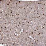 DBNDD2 Antibody in Immunohistochemistry (IHC)