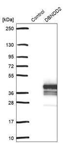 DBNDD2 Antibody in Western Blot (WB)