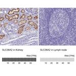 SLC36A2 Antibody in Immunohistochemistry (IHC)