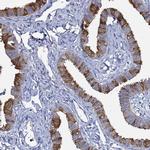 RABL2A Antibody in Immunohistochemistry (IHC)