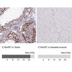 C19orf57 Antibody