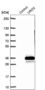 UROS Antibody in Western Blot (WB)