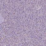 NHP2 Antibody in Immunohistochemistry (IHC)