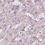 NHP2 Antibody in Immunohistochemistry (IHC)