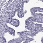 RNase12 Antibody in Immunohistochemistry (IHC)