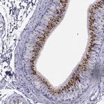 RNase12 Antibody in Immunohistochemistry (IHC)