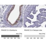 RNase12 Antibody