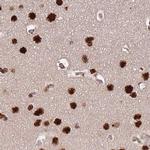 HDGFRP2 Antibody in Immunohistochemistry (IHC)