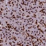 HDGFRP2 Antibody in Immunohistochemistry (IHC)