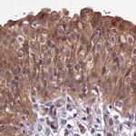 MKKS Antibody in Immunohistochemistry (IHC)