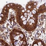 MKKS Antibody in Immunohistochemistry (IHC)