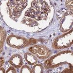 MKKS Antibody in Immunohistochemistry (IHC)