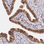 SBP2 Antibody in Immunohistochemistry (IHC)