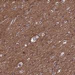 NELF Antibody in Immunohistochemistry (IHC)