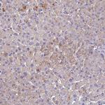 SLC13A5 Antibody in Immunohistochemistry (IHC)