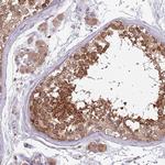 USP32 Antibody in Immunohistochemistry (IHC)