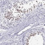 C17orf64 Antibody in Immunohistochemistry (IHC)