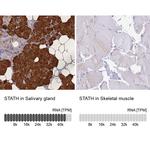 STATH Antibody in Immunohistochemistry (IHC)