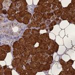 STATH Antibody in Immunohistochemistry (IHC)