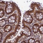 HINT1 Antibody in Immunohistochemistry (IHC)