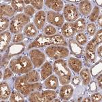 HINT1 Antibody in Immunohistochemistry (IHC)