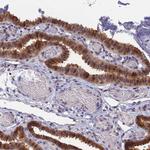 HINT1 Antibody in Immunohistochemistry (IHC)