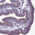 BBS7 Antibody in Immunohistochemistry (IHC)