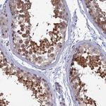 SRA1 Antibody in Immunohistochemistry (IHC)